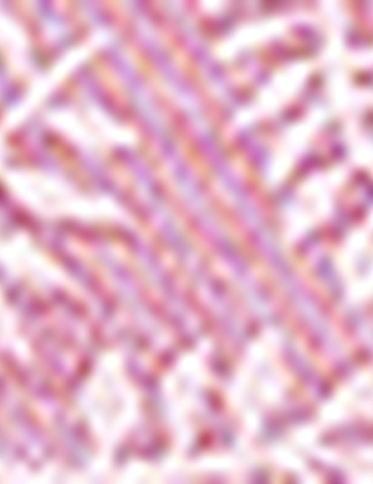 Pembe Tişört - 50171685026