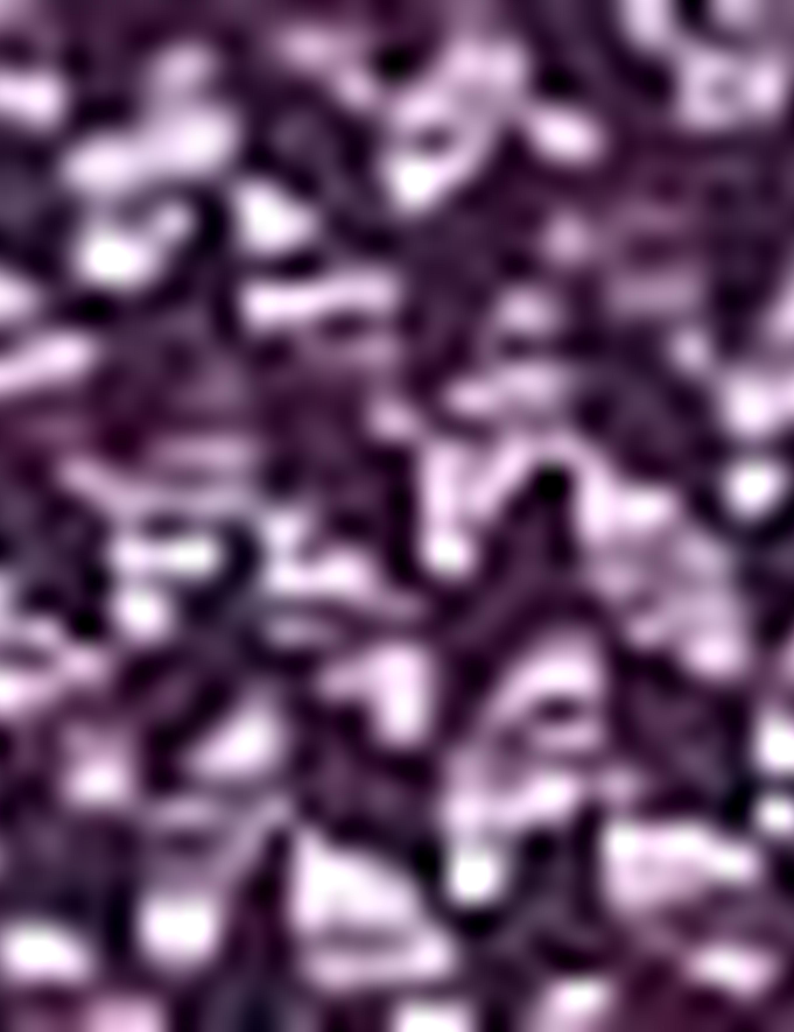 Mor Slim Fit Tişört