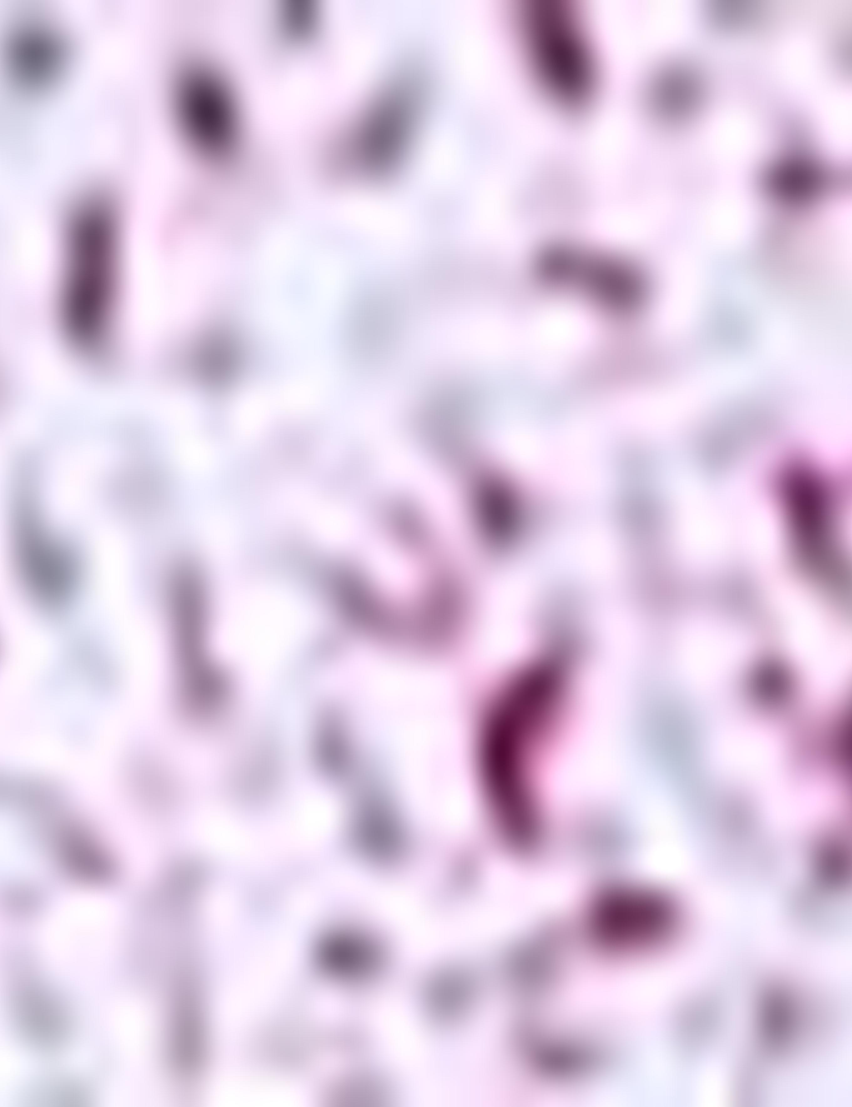 Bordo Slim Fit Uzun Kollu Gömlek