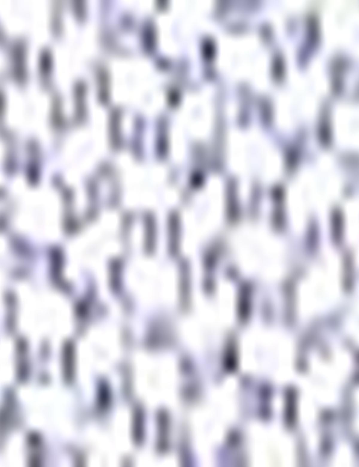 Lacivert Slim Fit Polo Yaka T-Shirt - 50205618005