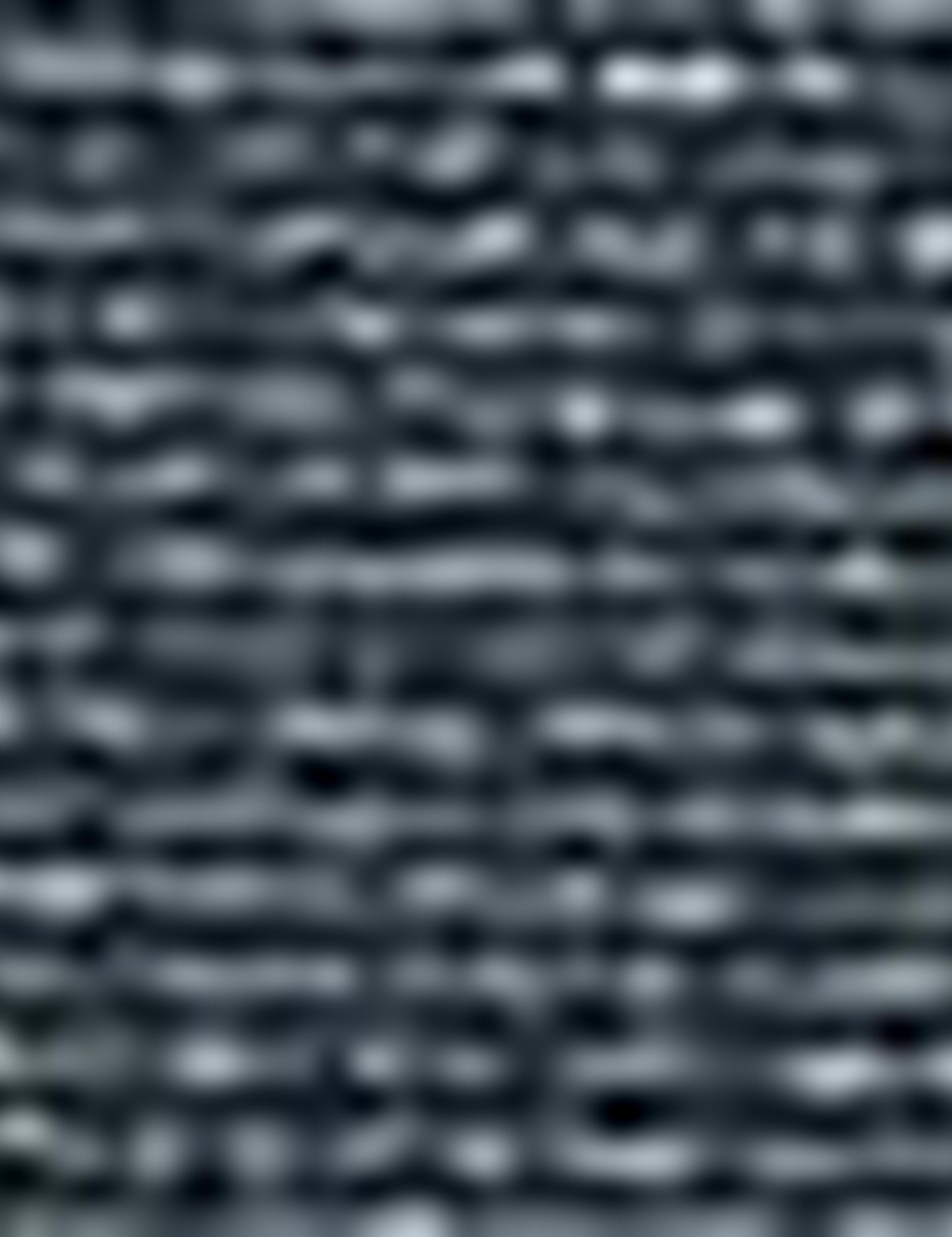 Koyu Yeşil Slim Fit V Yaka T-Shirt