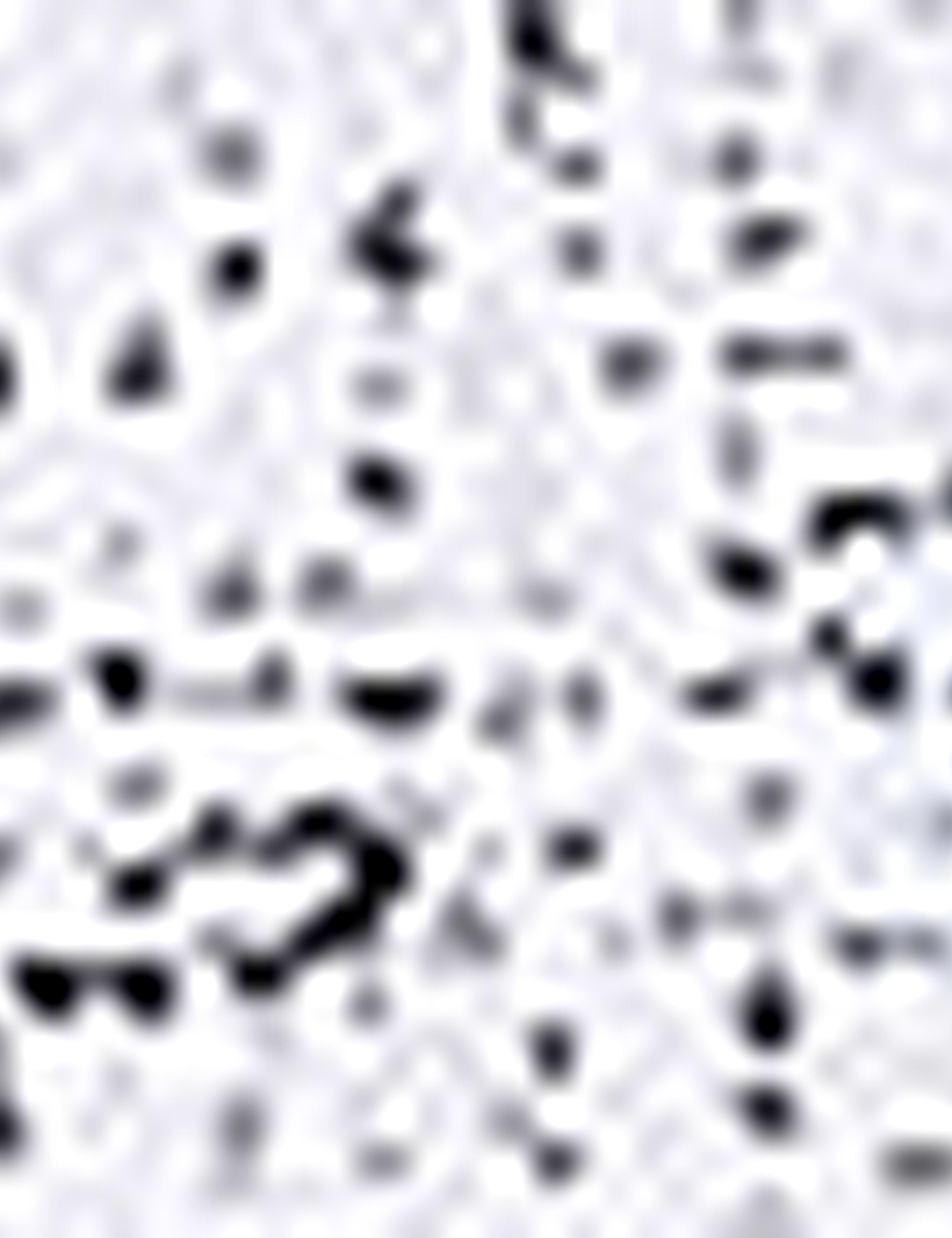 Lacivert Slim Fit Polo Yaka T-Shirt