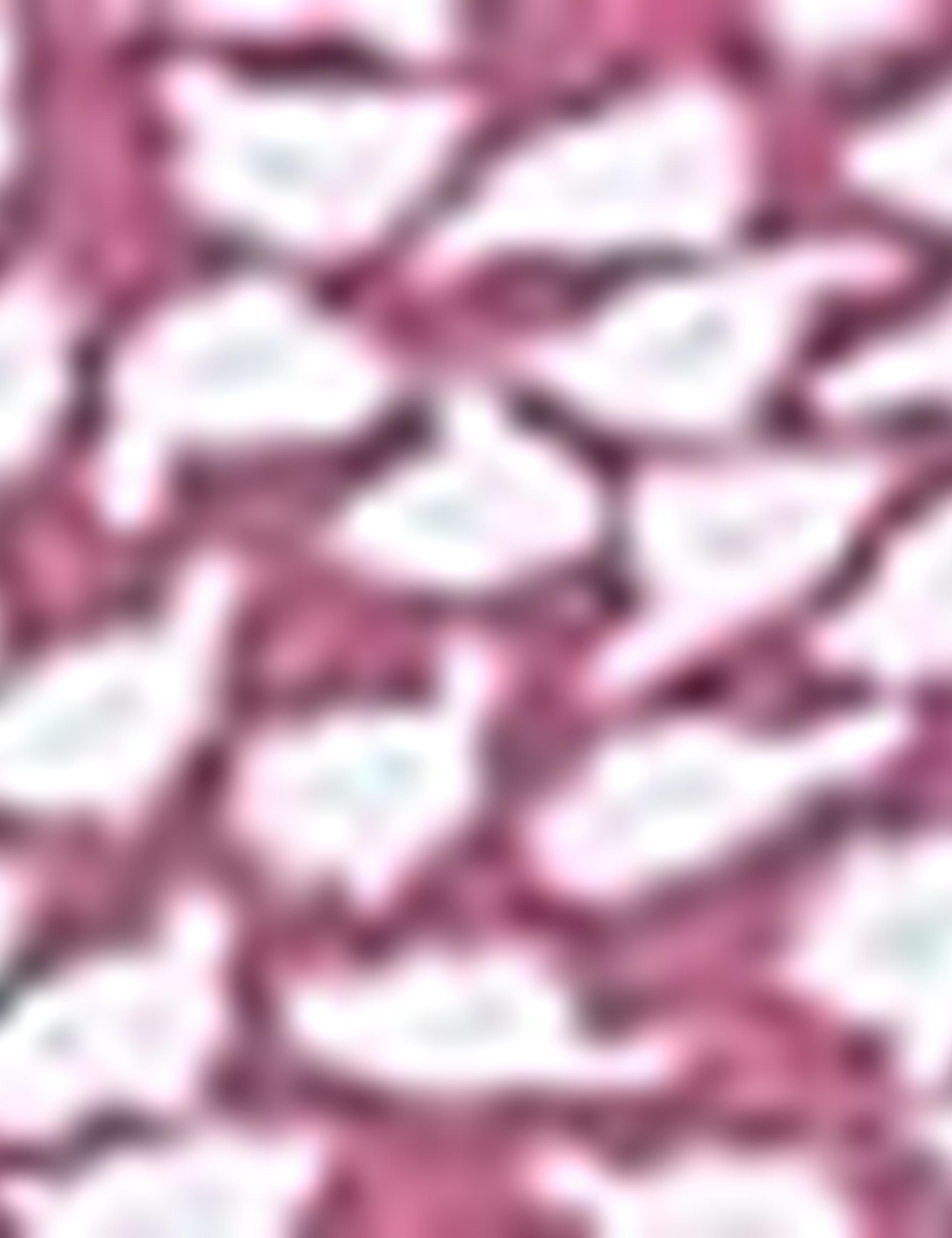 Pembe Slim Fit Polo Yaka T-Shirt