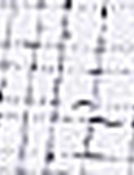 Lacivert Slim Fit Gömlek - 50211190013