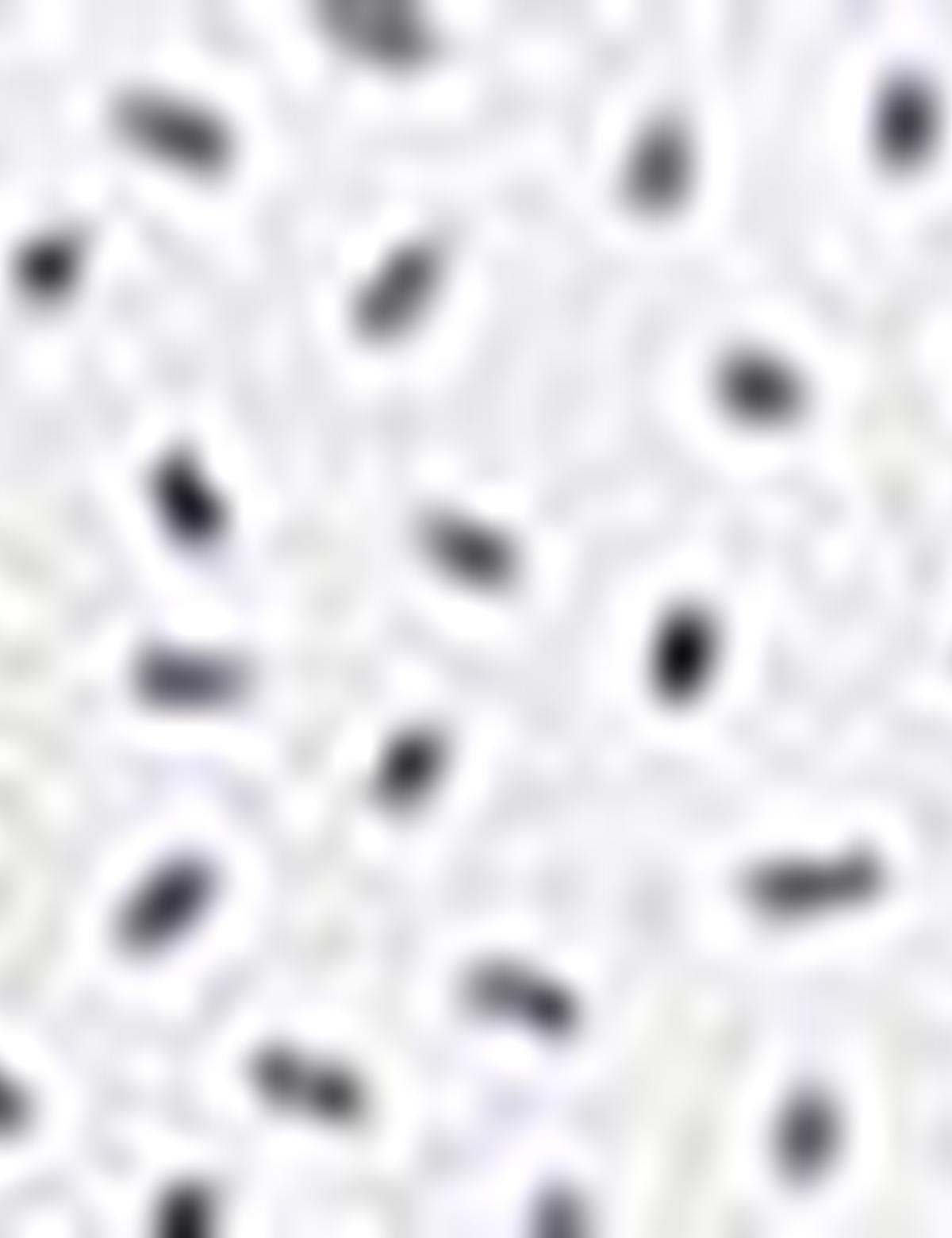 Lacivert Slim Fit Gömlek - 50211201003