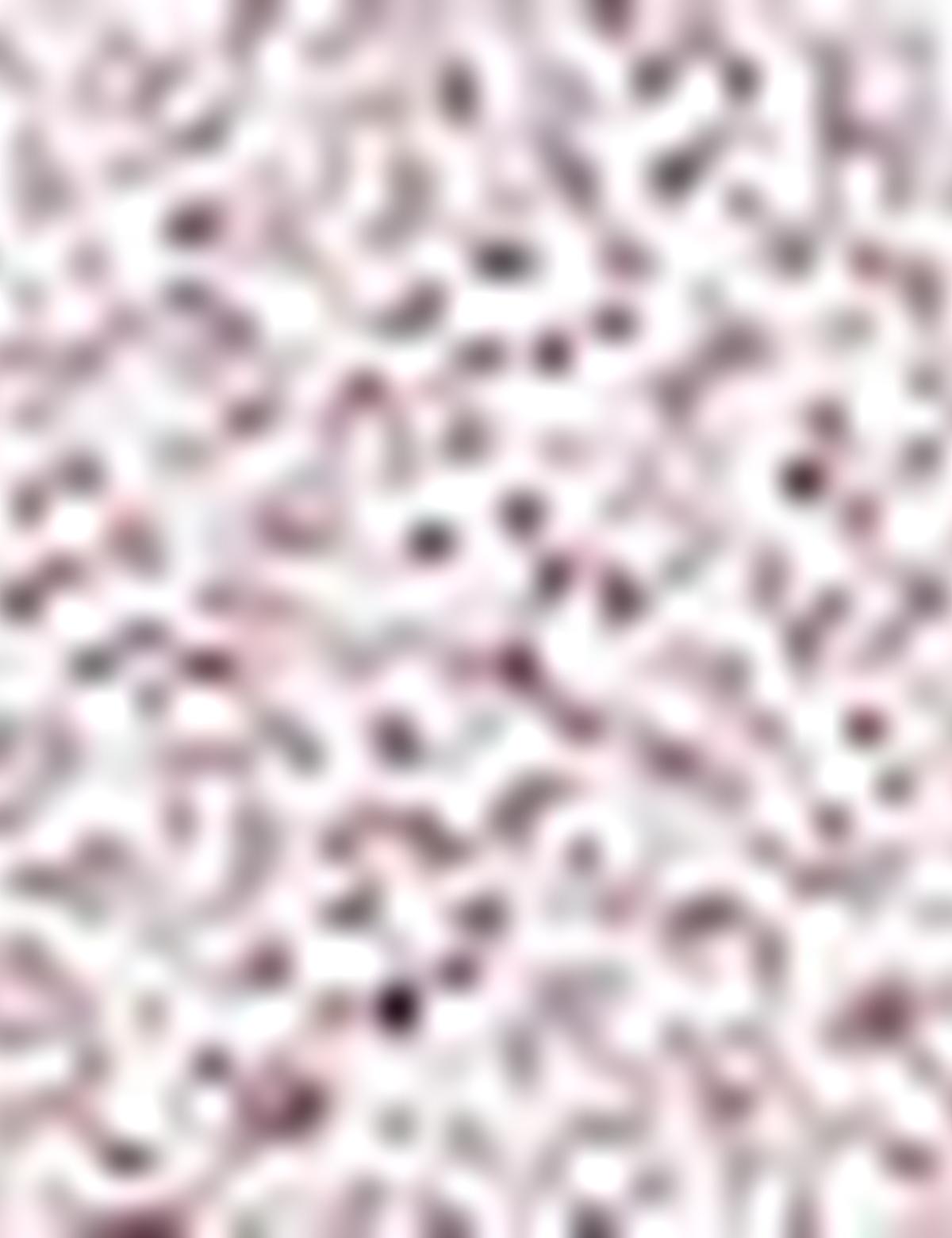 Bordo Slim Fit Gömlek - 50211219006