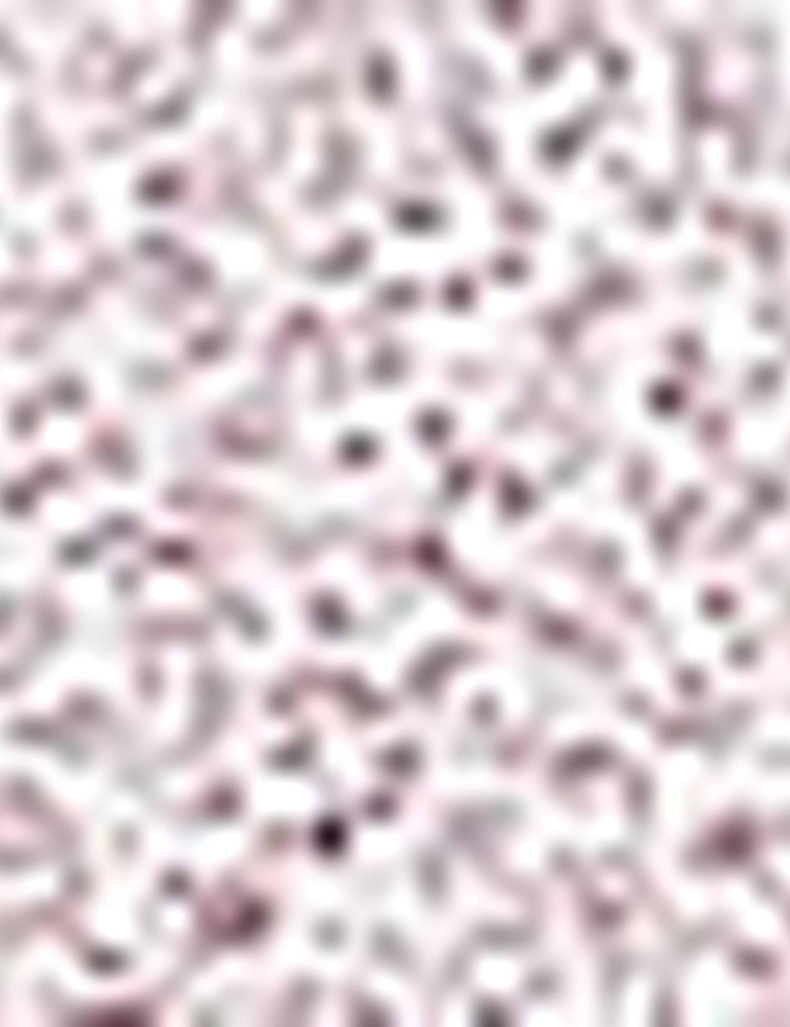 Bordo Slim Fit Gömlek