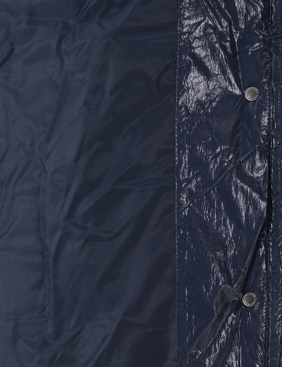 Lacivert Yelek - 50290343041