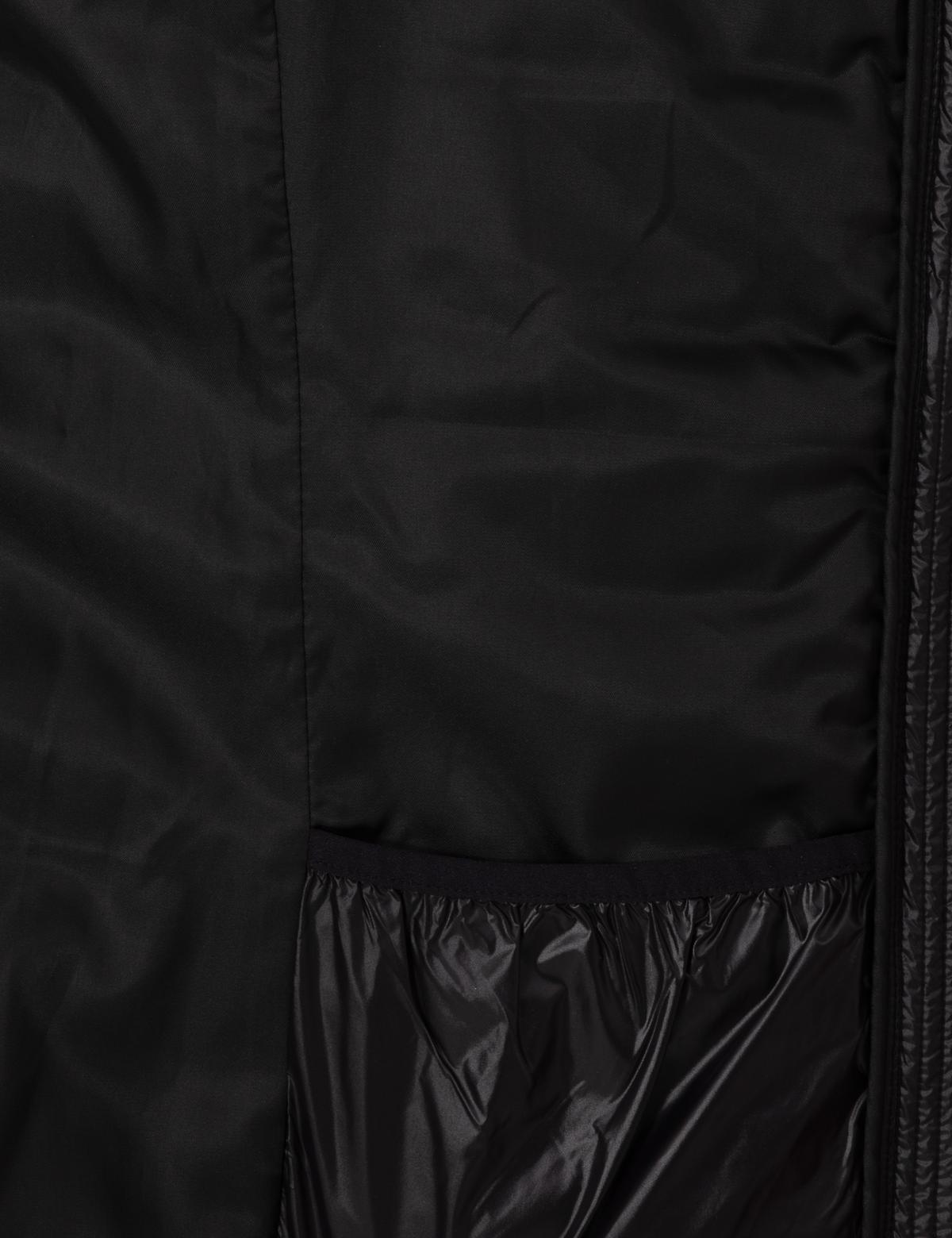 Siyah Çıkarılabilir Kapüşonlu Mont - 50314169002